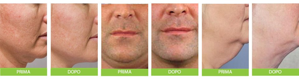 DS Vexum SL Crema Doppio Mento 50 Ml (kit 3 confezioni)