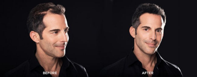 Toppik Triple Kit 55.0 Gr. - Castano Chiaro