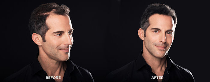 Toppik Hairline Optimizer